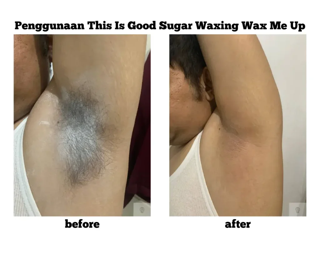 Review Produk Waxing : This Is Good Sugar Waxing Wax Me Up 1 Before After Penggunaan This Is Good Sugar Waxing Wax Me Up